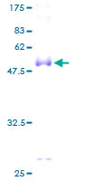 12.5% SDS-PAGE Stained with Coomassie Blue.